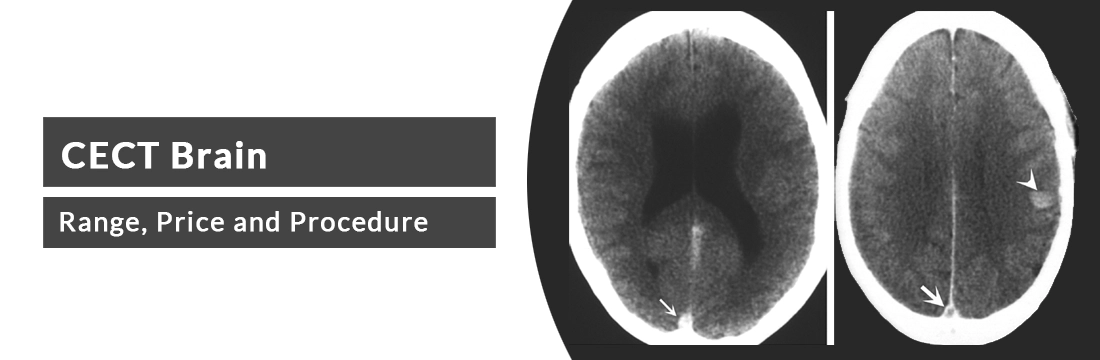 CECT Brain: Purpose and Cost